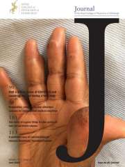 Journal of the Royal College of Physicians of Edinburgh Journal Subscription